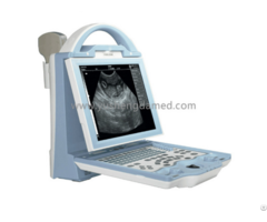 Full Digital Portable Ultrasound Scanner Ysd1208