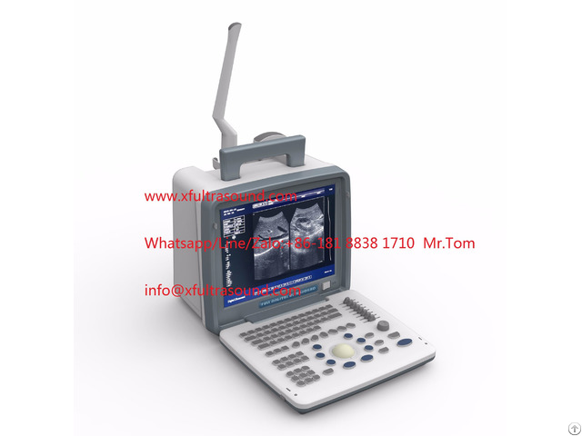 B And W Portable Ultrasound Scanner Xf300 Led