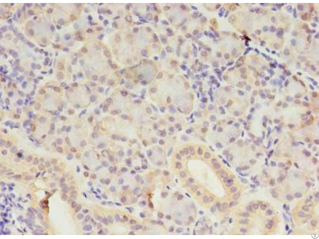 Samd3 Antibody