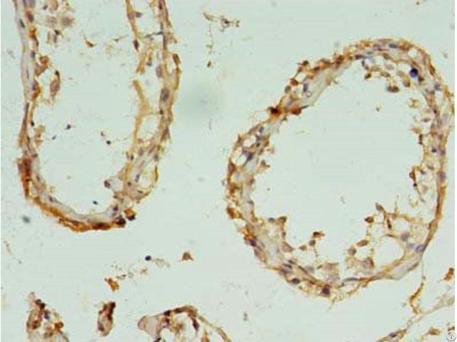 Rbm11 Antibody