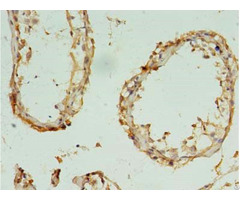 Rbm11 Antibody