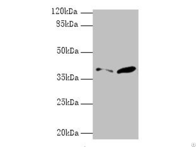 Psmd7 Antibody