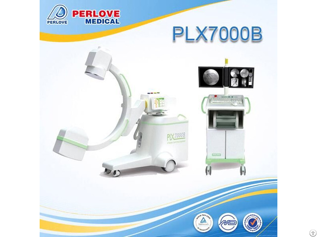 Peripheral Angiography By Chinese C Arm System Plx7000b