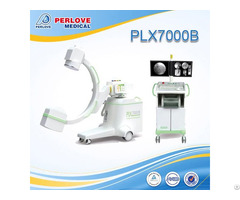 Peripheral Angiography By Chinese C Arm System Plx7000b
