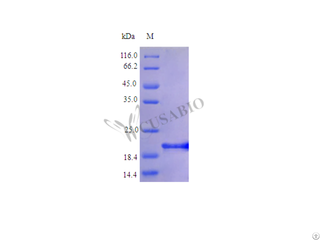 Recombinant Human Interleukin 6 Protein Il6