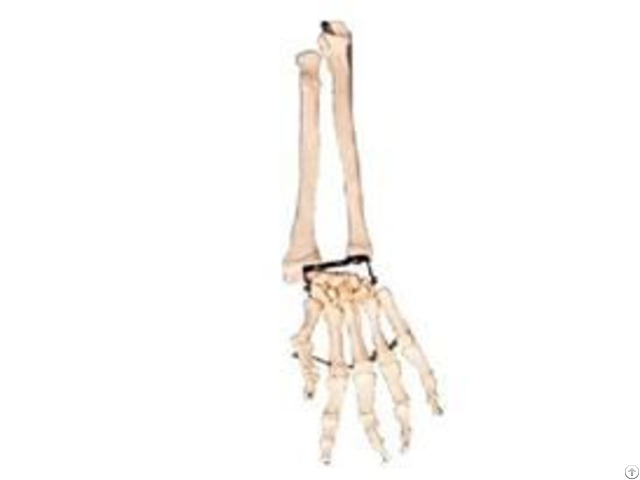 Jy A1013 Palm With Elbow And Radial Bone