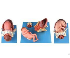 Jy A6140 Demonstration Model Of Childbirth