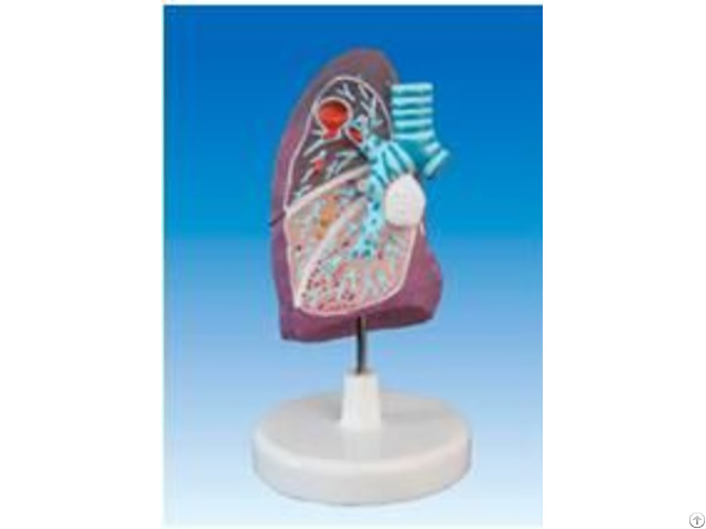 Jya4015 Pulmonary Pathological Model