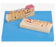 Jy B10007 Dissected Model Of Teeth Tissue