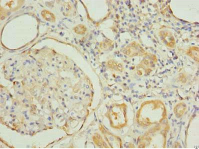 Rnf31 Antibody