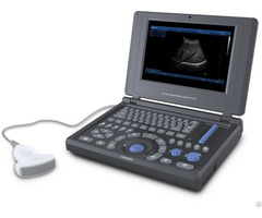 A10 Full Digital Laptop Ultrasonic Diagnostic System