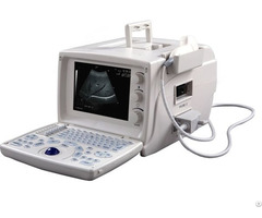 A40 Basic Portable Ultrasound Machine
