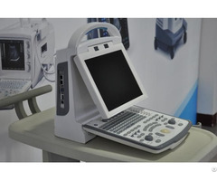 Canyearn C10 Full Digital Portable Ultrasonic Diagnostic System Color Doppler Ultrasound Scanner