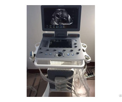 C95 Plus Built In Trolley Color Doppler Ultrasound Scanner With Touch Screen