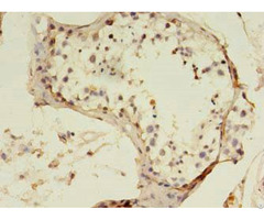 Sart3 Antibody