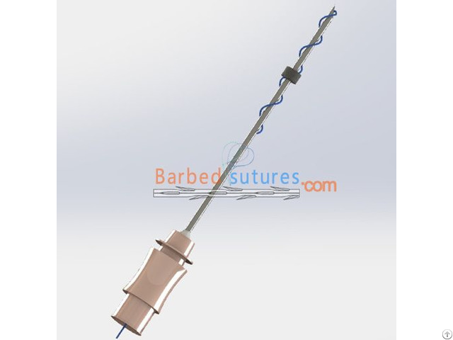 Pdo Screw Lift Needle