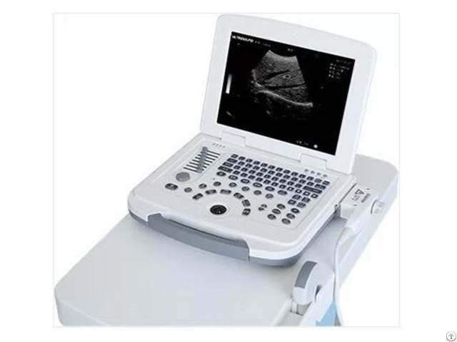 Laptop Ultrasound Machine Specifications Zero 500