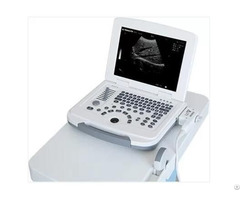 Laptop Ultrasound Machine Specifications Zero 500