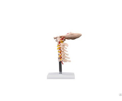 Life Size New Style Cervical Vertebral W Neck Artery Spine Models Wholesale