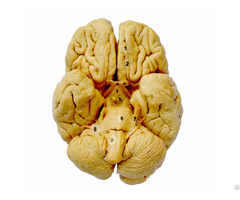 Whole Brain Plastination Specimen