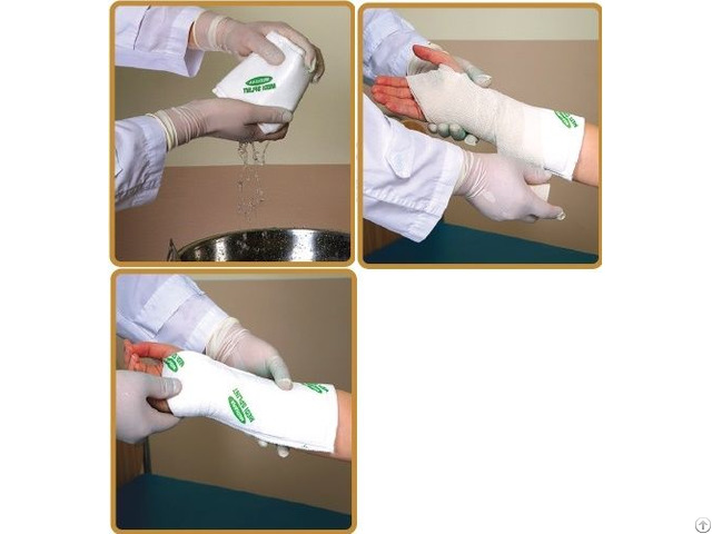 Medical Splint Top Point