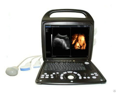 Ultrasound Bene 3v