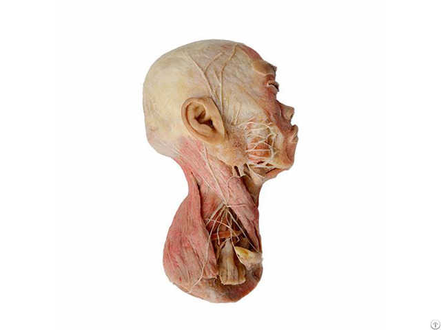 Superficial Muscle Of Head Plastination Specimen For Teaching Anatomy