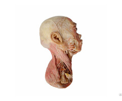 Superficial Muscle Of Head Plastination Specimen For Teaching Anatomy