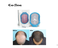 Portable Bald Laser Head Hair Growth Treatment Helmet For Home Remedy
