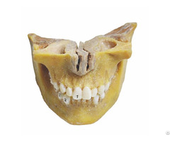 Deciduous Teeth Plastinates Human Medical Specimens