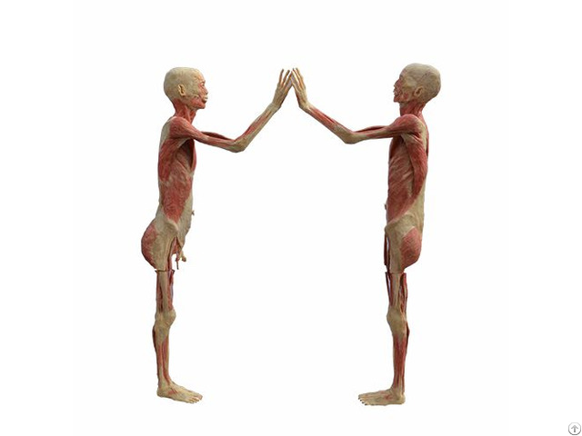 High Five Body Plastinated Specimen