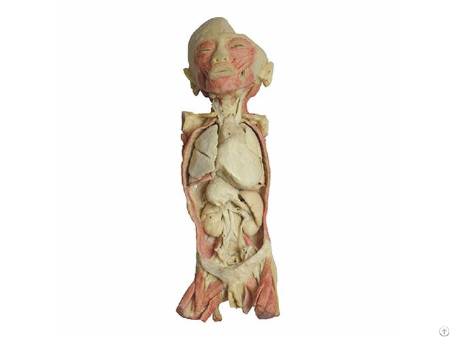 Overview Of The Endocrine System Body Plastination Exhibit
