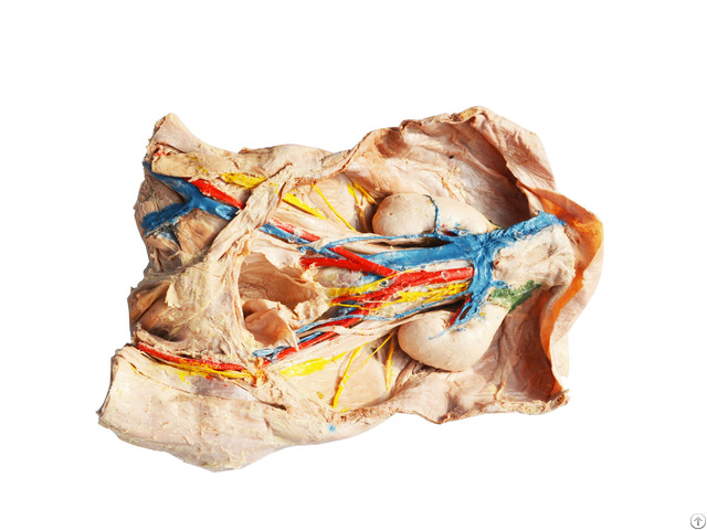 Inferior Vena Cava Plastination Specimen