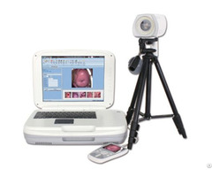 Ykd 3004 Portable Digital Colposcope