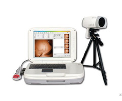 Ykd 1004 Portable Infrared Breast Examination Equipment