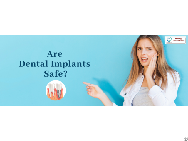 Dental Clinic In Bangalore