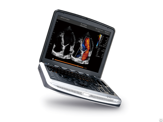 Sonobook 8 Portable Laptop Ultrasound Machine