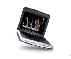 Sonobook 8 Portable Laptop Ultrasound Machine