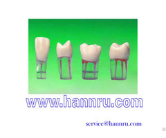 Endodontic Tooth Model
