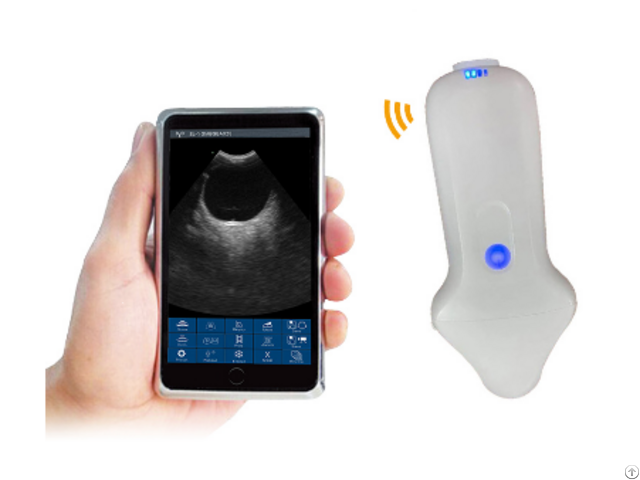 Micro Convex Palm Doppler Ultrasound Scanner