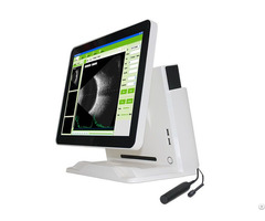 Ophthalmic A B Scanner