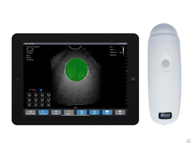 4d Wireless Bladder Ultrasound Scanner