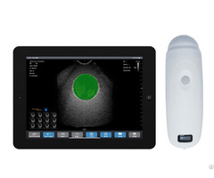 4d Wireless Bladder Ultrasound Scanner