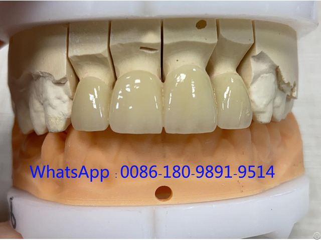 China Dental Outsourcing