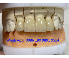 China Dental Outsourcing