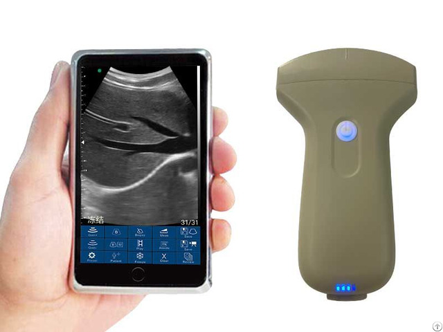 Onvex Palm Doppler Ultrasound