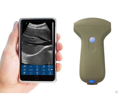 Onvex Palm Doppler Ultrasound