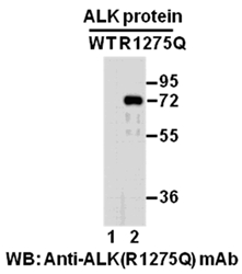Anti Alk R1275q Mouse Monoclonal Antibody