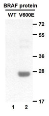 Anti B Raf V600e Mouse Monoclonal Antibody