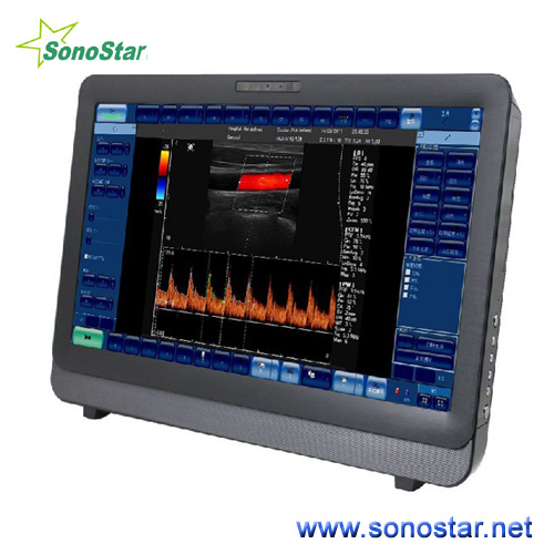 C8 Color Doppler Ultrasound System Touch Screen